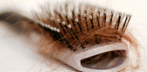 natural solution for hair loss