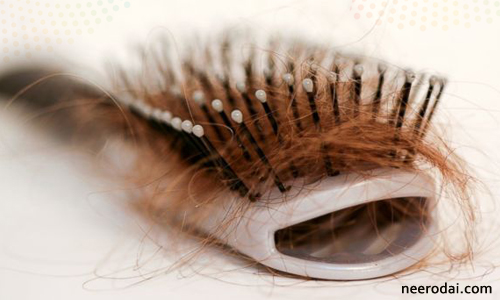 natural solution for hair loss